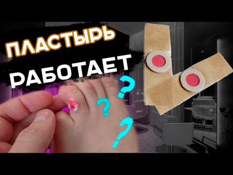 ✅ Пластырь с Алиэкспресс Реально Работает ? ? ? Мой личный опыт