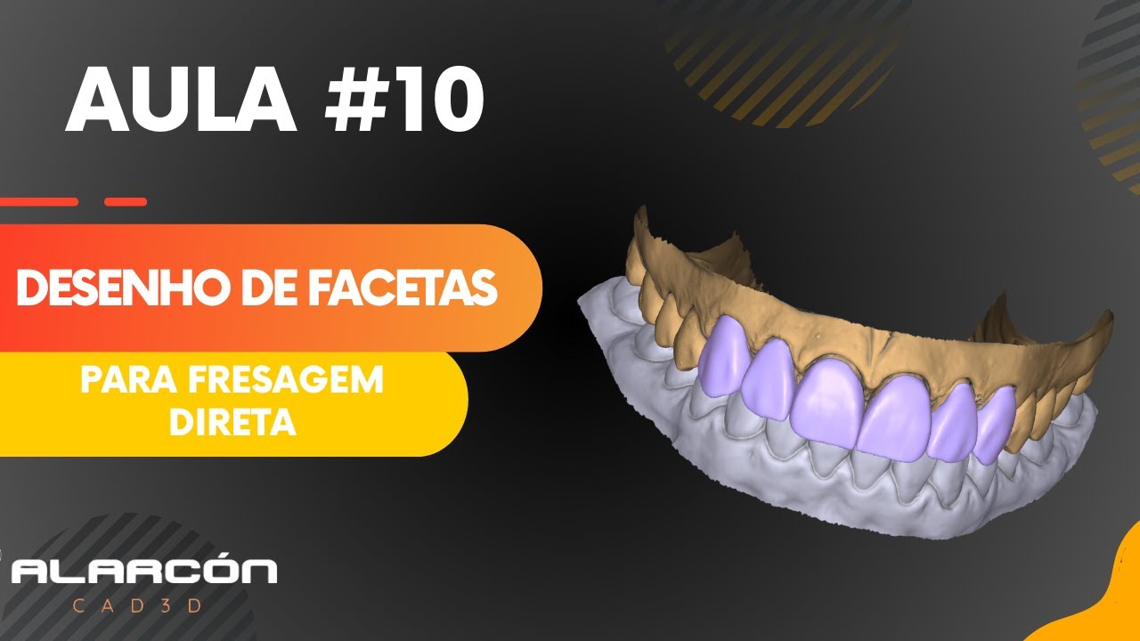 DESENHO DE FACETAS PARA FRESAGEM DIRETA #fluxodigital #cad #exocad