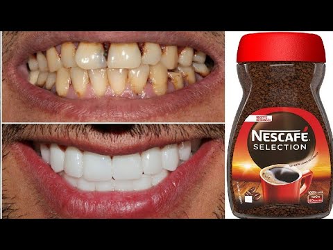 teeth whitening at home in 2 minutes / how to naturally whiten your yellow teeth