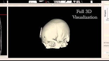 CVIU_Probablistic model for 3D interactive segmentation