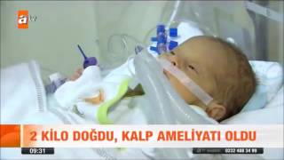 Prof. Dr. Süleyman Özkan - Atv Kahvaltı Haberleri