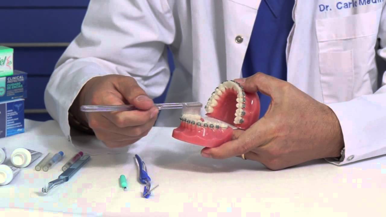 Ortodoncia Como Cepillarse Los Dientes Y Usar Hilo Dental Con