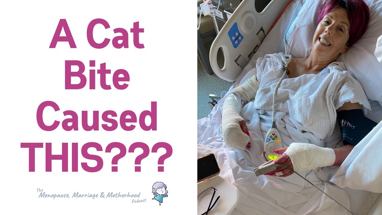 What Happens When You Get A Cat Bite (It's Not As Simple As A Tetanus