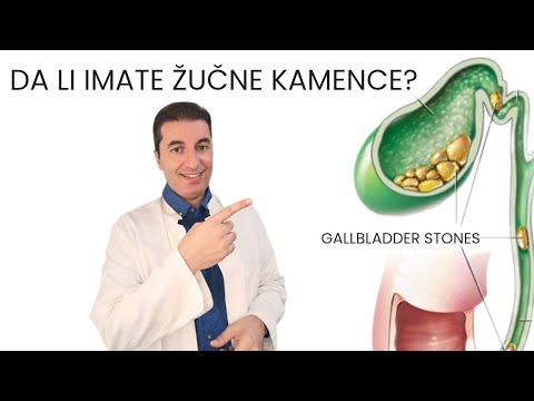 Video: Môžu žlčové kamene spôsobiť zlý vietor?