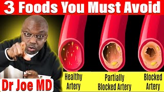 3 Popular Foods That Harm Your Arteries - Avoid