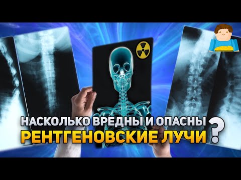 Насколько вреден рентген? | Plushkin