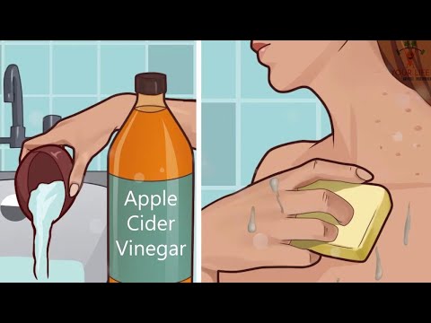 Put Apple Cider Vinegar on Your Face and See what Happens to Toxins, Eczema, and Age Spots
