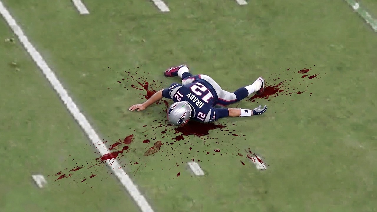 Injuries That Changed NFL History!