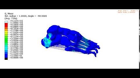 Patient-Specific Finite element simulation of foot in Stance Phase