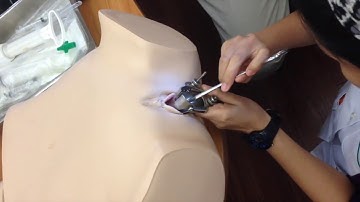 Manual Vacuum Aspiration mp4