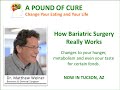 How Bariatric Surgery Really Works -  changes your hunger, metabolism and even your taste buds.