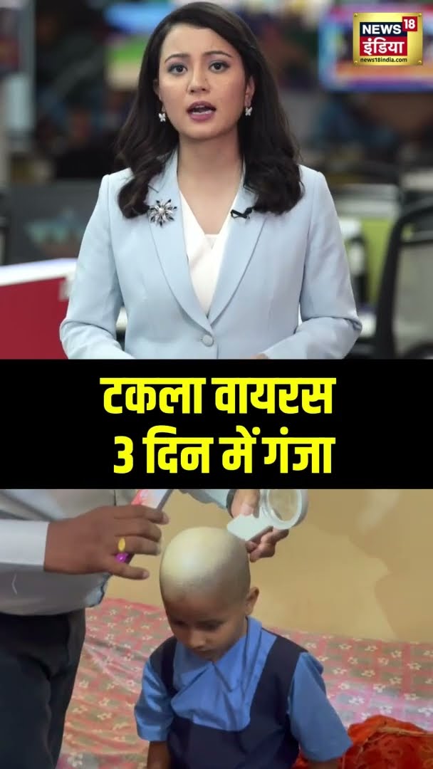 नए वायरस से हड़कंप, Maharashtra में गाँव के गाँव हो रहे गंजे | Viral Video | #shorts