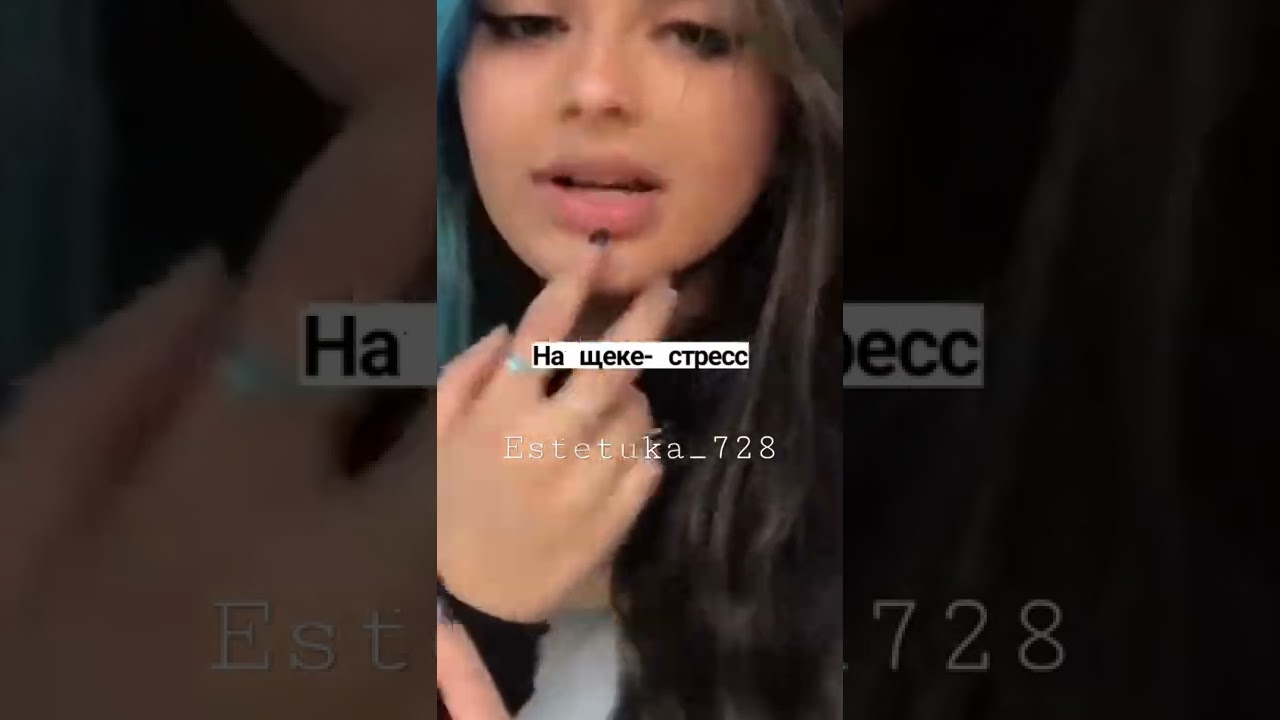 🕸Значение прыщей на лице🕸