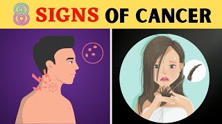 8 Signs You Have Cancer and Don't Know It