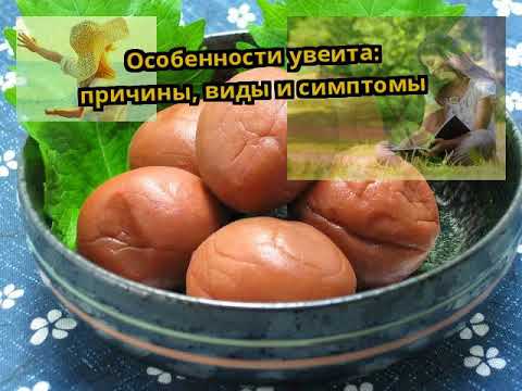 Особенности увеита: причины, виды и симптомы