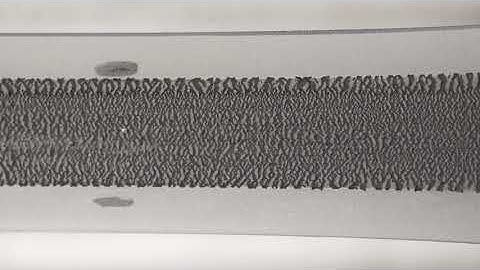 Resistive screen-printed strain sensor