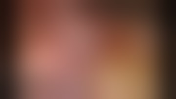 Retraction Techniques for Robotic Lobectomy