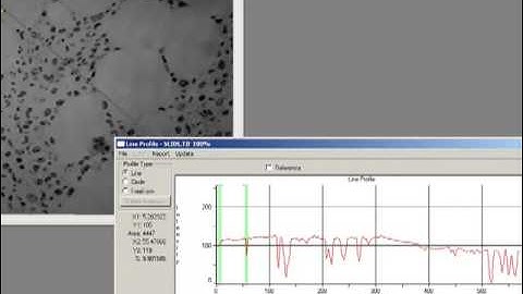 Threshold Editing & Background Correction - Image-Pro Plus Software