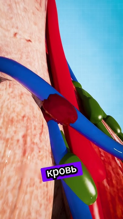 Что такое синяк 😨 #анатомия #anatomy #биология #медицина - YouTube