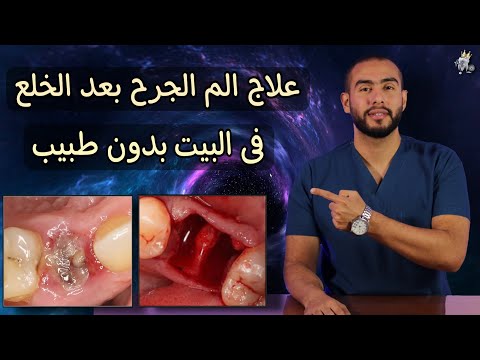 فيديو: 7 طرق لإصلاح الأسنان المخلبية (فرط)