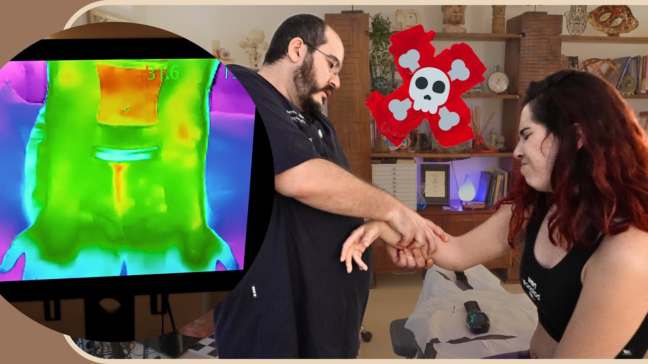 PAINFUL Adjustment: Brutal Manual Therapy 4 Deep Knots! Chiropractic Treatment HELPED ARM & POSTURE