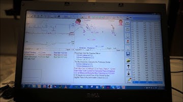 OCCLUSION CONNECTIONS K7 Jaw Tracking Technology