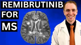 Remibrutinib for Multiple Sclerosis