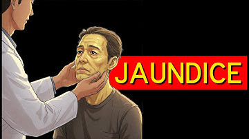 Why Your Skin Turns Yellow: Jaundice Explained Simply!