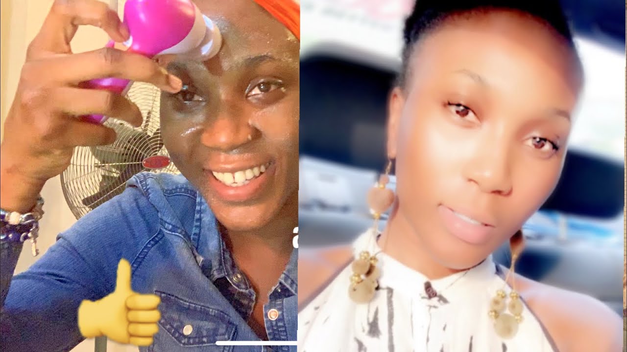 MY 8 STEPS SKIN CARE ROUTINE FOR ACNE, SUNBURN AND DARK EYES CIRCLES