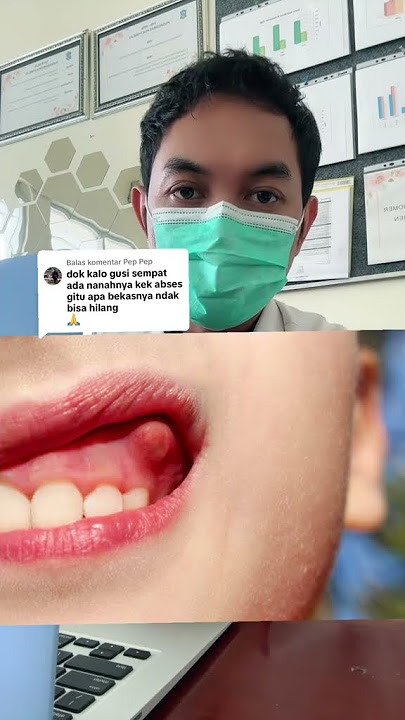 Abses gusi jangan dianggap sebagai hal yang biasa karena sejatinya itu hal yang perlu dilakukan