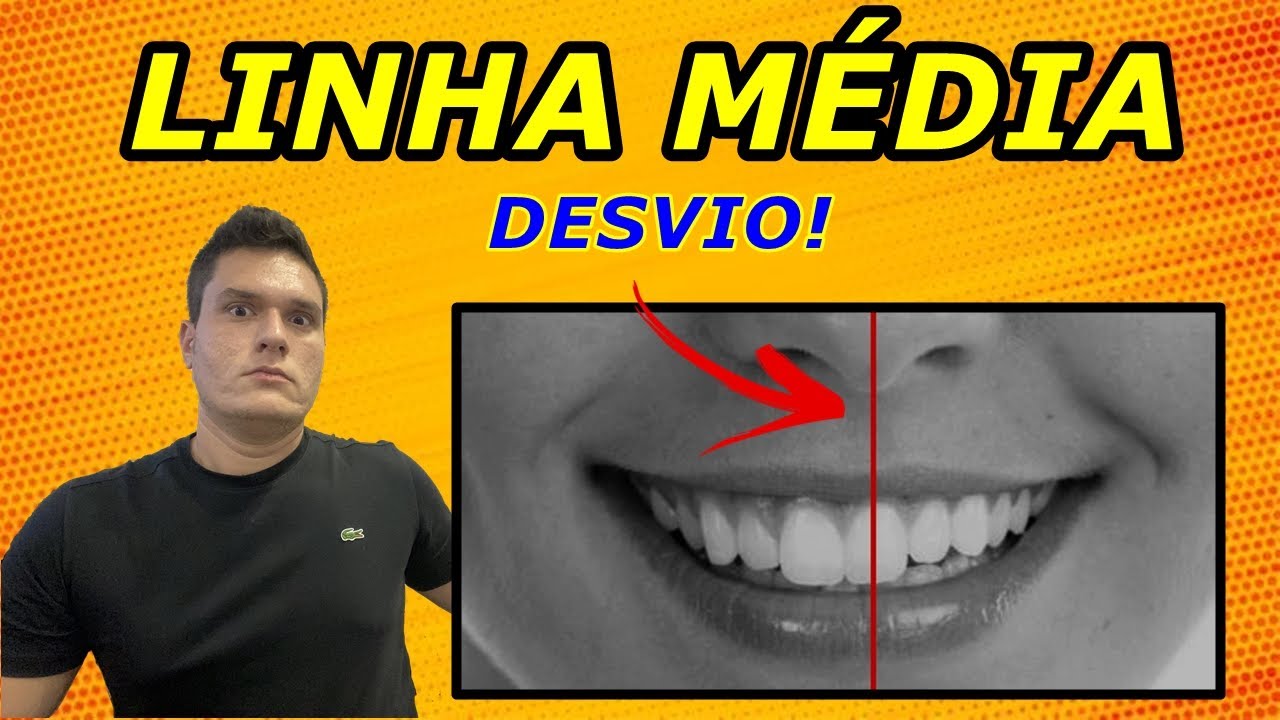 DESVIO DE LINHA MÉDIA DENTÁRIA | COMO O DENTISTA CORRIGE COM APARELHO ORTODÔNTICO?