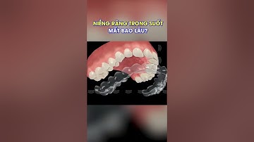 Niềng răng trong suốt mất bao lâu? #shorts #nhakhoa