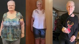 Is Gastric Bypass Surgery Right for you?  Barbara's Story