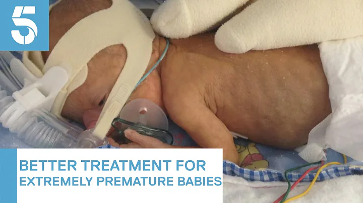 Doctors should try to save premature babies born after 22 weeks, medical leaders say | 5 News