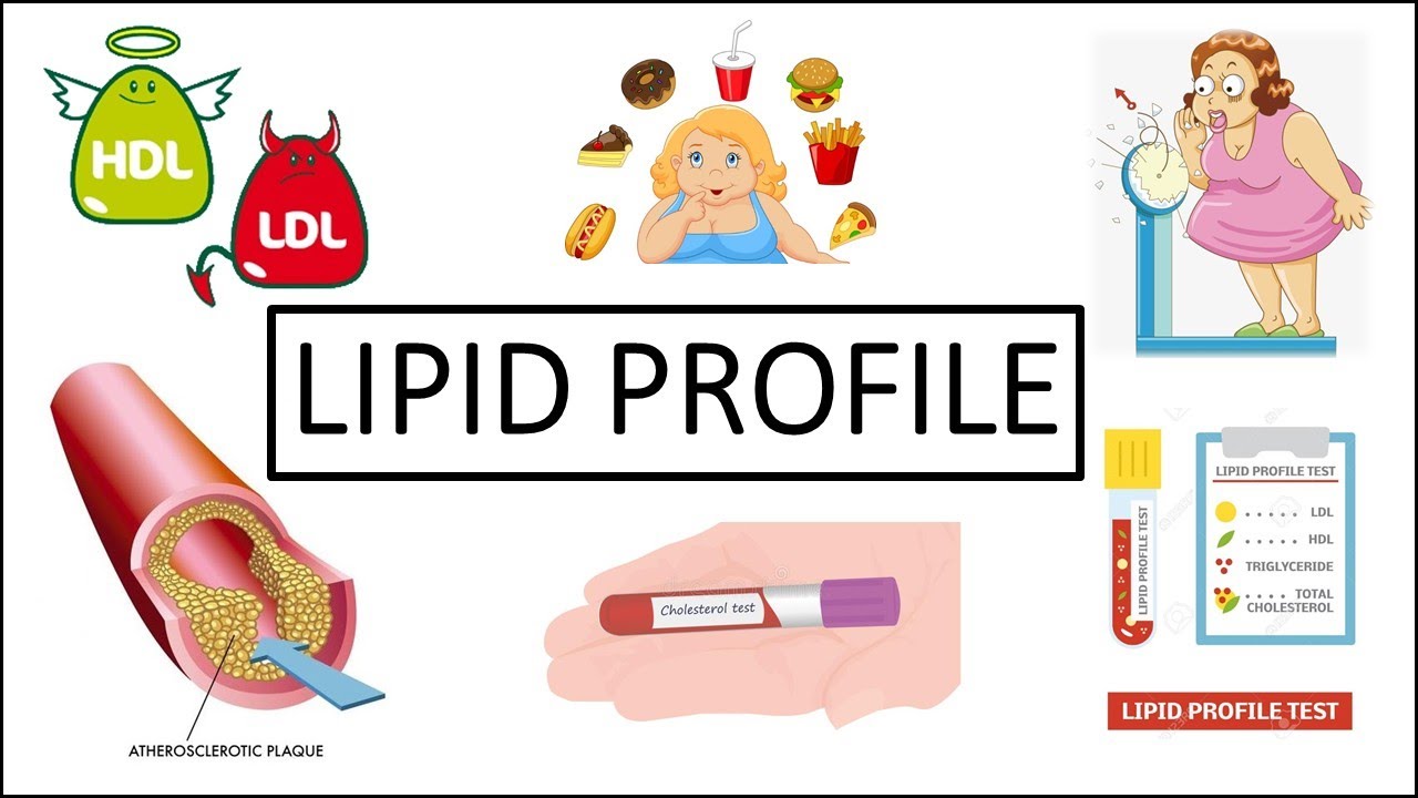 Lipid Profile Clear Explanation Lipidprofile MLT Medilabacademy Lipid Profile Clear Explanation Lipidprofile MLT Medilabacademy