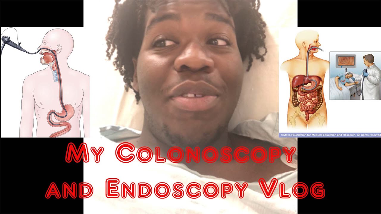 My Colonoscopy and Endoscopy YouTube