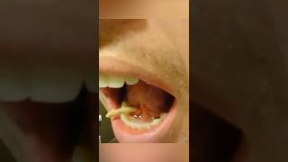 Is That A Worm In His Mouth?