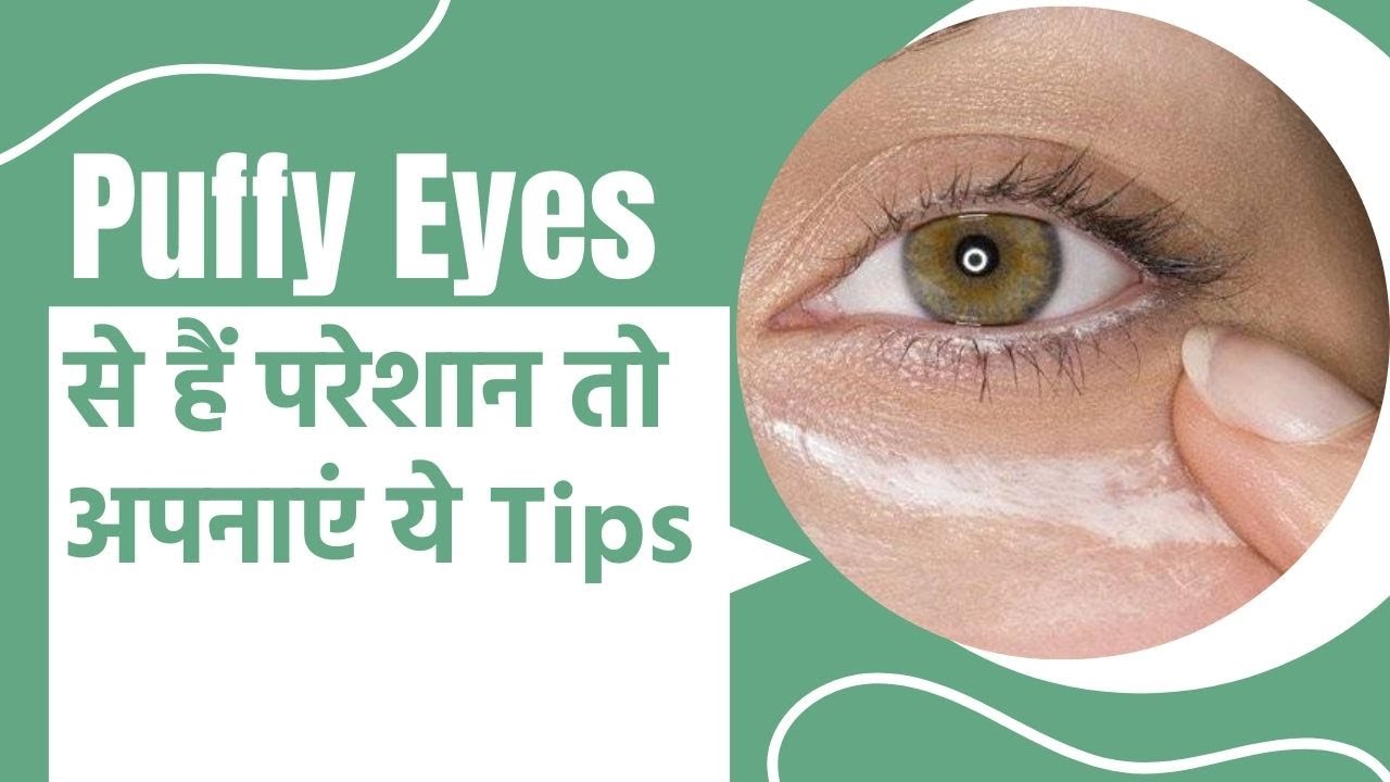 Puffy Eyes से परेशान हैं तो अपनाएं ये Tips Puffy Eyes Easy Home