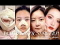 I Got Plastic Surgery in Korea: Part 2 ⎮BEFORE & AFTER, SURGERY, RECOVERY ⎮Emily Quak