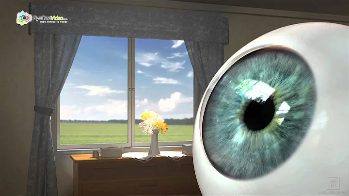 Dr. Robert C. Layman - Contact Lenses