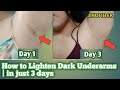 HOW TO LIGHTEN DARK UNDERARMS  | IN JUST 3 DAYS