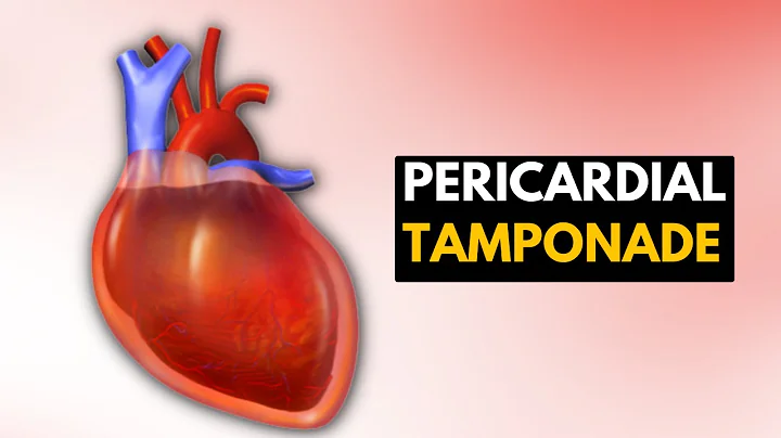 Pericardial Tamponade: Everything You Need To Know - DayDayNews