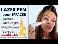 Stylo Laser Anti Tache Avis