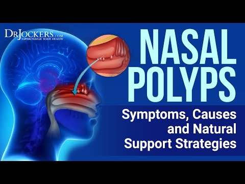 Video: Nasal Polypper Naturlig Behandling: 12 Hjemmebehandlinger