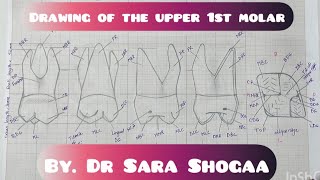 Drawing of the upper 1st molar (part 1) by Dr. Sara Shogaa