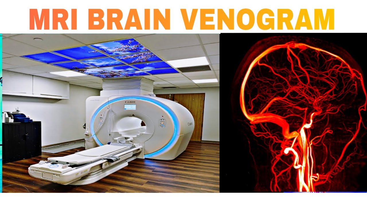 HOW TO DO MRI BRAIN VENOGRAM YouTube HOW TO DO MRI BRAIN VENOGRAM YouTube