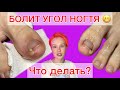 ВРОС НОГОТЬ | ЧТО ДЕЛАТЬ? | БОЛИТ УГОЛОК | ВРОСШИЙ НОГОТЬ НА НОГЕ #алена_лаврентьева #ногти