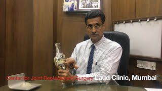 Knee Replacement Explained English screenshot 1
