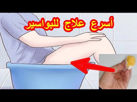 أقسم بالله دهنة واحدة علاج نهائي البواسير الداخليةوالخارجية والناسور الشرجى من أول استعمال بدون علاج