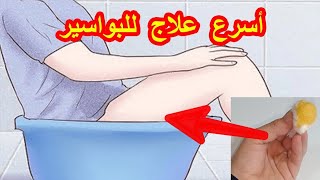 أقسم بالله دهنة واحدة علاج نهائي البواسير الداخليةوالخارجية والناسور الشرجى من أول استعمال بدون علاج youtube
